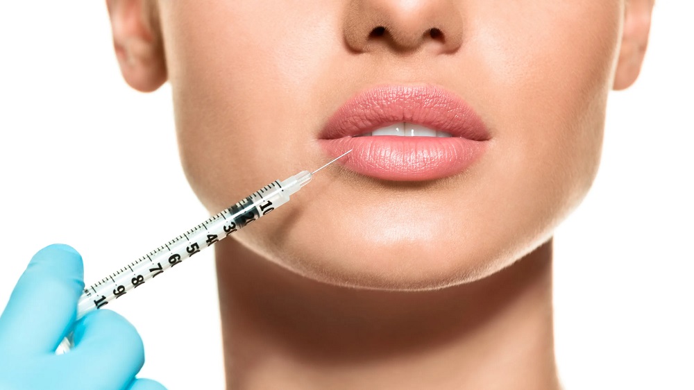 What To Expect From Lip Filler Procedure